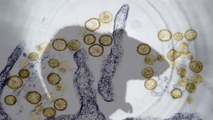 Hantavirus: cómo prevenir contagios en casa con 5 medidas básicas de protección