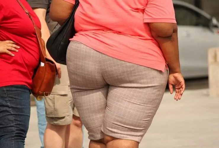 obesidad cirugías.jpg