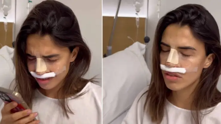 Influencer llora tras resultado de rinoplastia; internautas piden que no haga drama.jpg