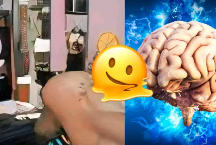 Derrame cerebral imagen