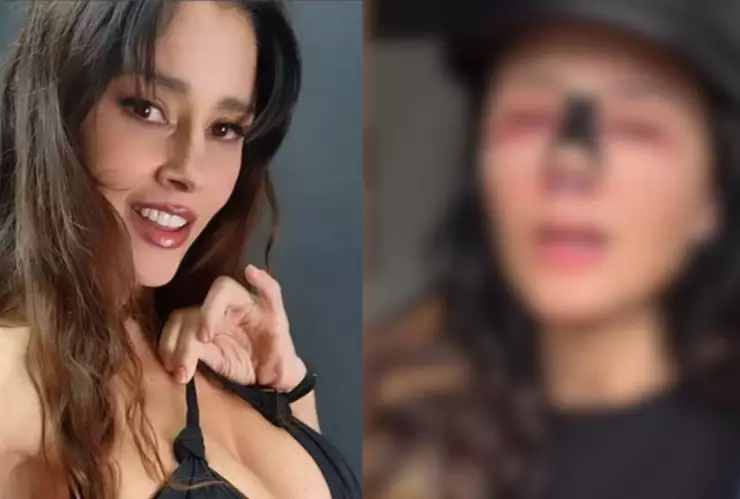 ¿Qué le pasó a Dorismar?