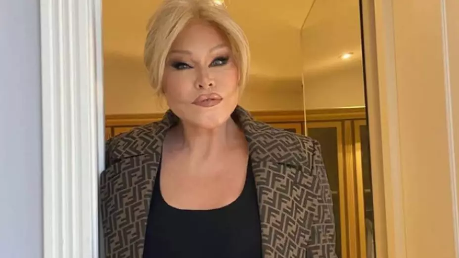 Fallece Jocelyn Wildenstein, “La Mujer Gato”: ¿de qué murió?