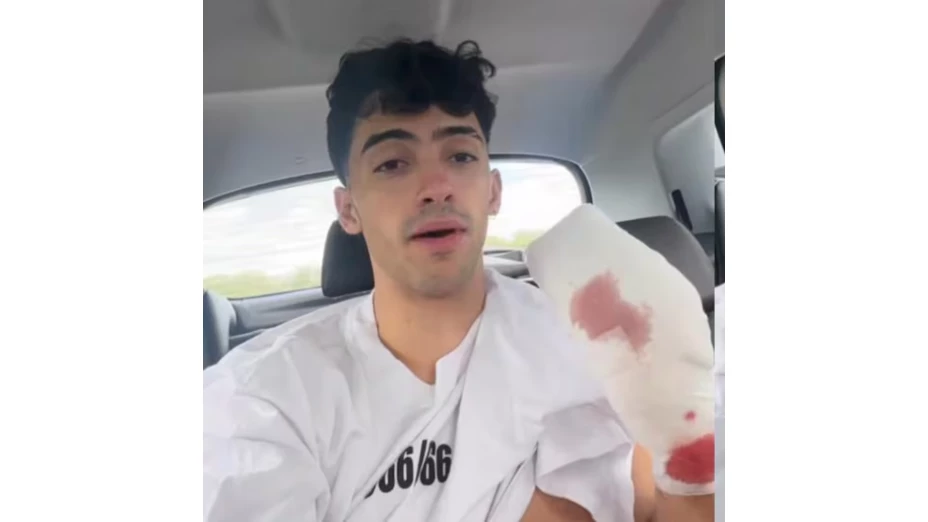 Reportan que el influencer sufre CAÍDA a 10 metros de altura; perdió DOS DEDOS de la mano tras el accidente