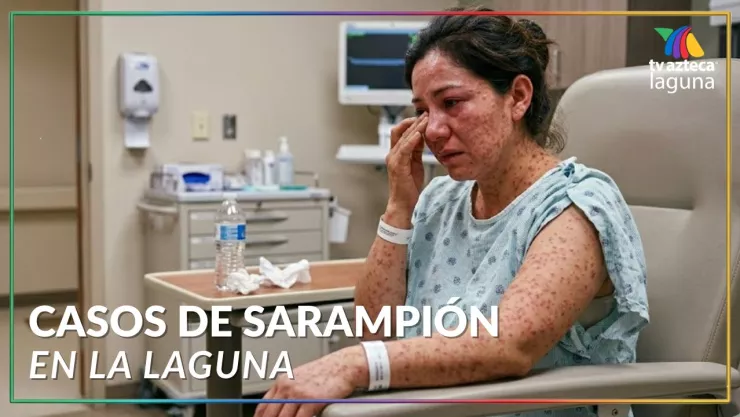 Sarampión La Laguna: número casos HOY 27 febrero 2026