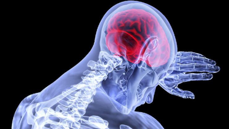 derrame_cerebral_.png