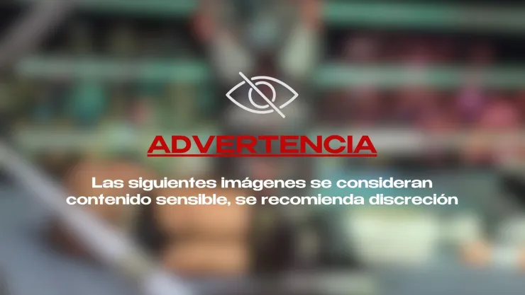 ¡IMÁGENES FUERTES! Famoso luchador sufre lesión en pleno ring; tuvieron que retirarlo en camilla