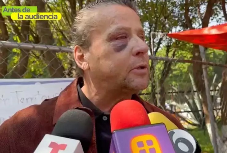 Alfredo Adame asegura que podría perder el ojo tras golpiza.