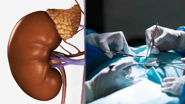 Hombre vende el riñó de su esposa.jpg