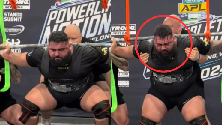 VIDEO | Levantador de pesas sangra por la cabeza durante competencia en Australia; ¿qué le pasó?