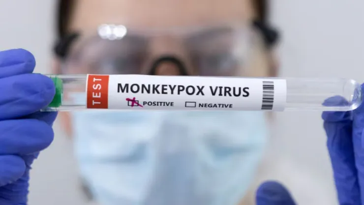 Mpox Virus del mono en Jalisco 3 casos México controlados
