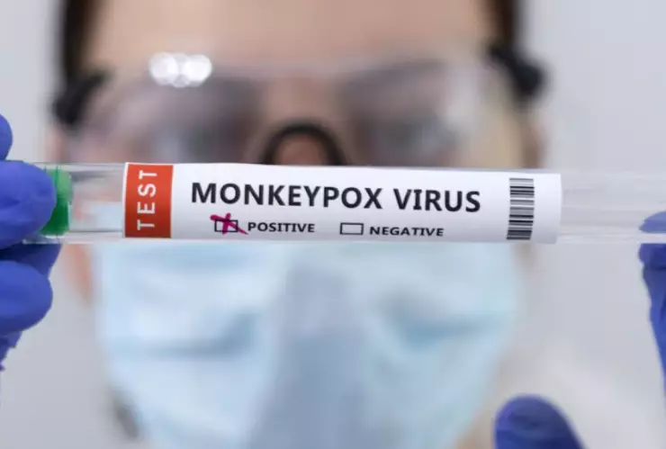 Mpox Virus del mono en Jalisco 3 casos México controlados