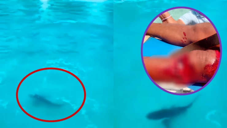 Pescador sobrevive a mordida de tiburón en Quintana Roo ¡Termina con una rotula destrozada!