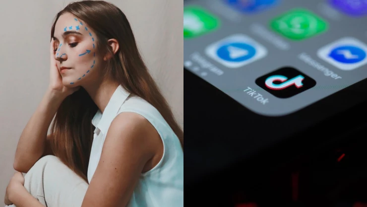 cirugias-esteticas-tik-tok-filtros-bold-glamour