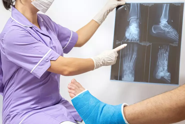 Bone 02: el gel que promete reparar fracturas en minutos sin cirugía