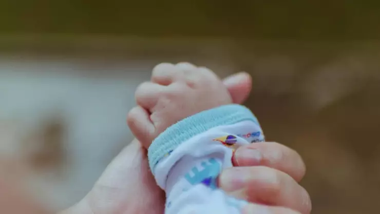 Nace bebé con dos caras, cuatro brazos y cuatro piernas en la India.