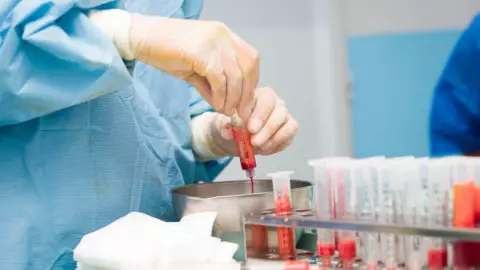 Enfermera muere por liposucción fallida en Cuernavaca