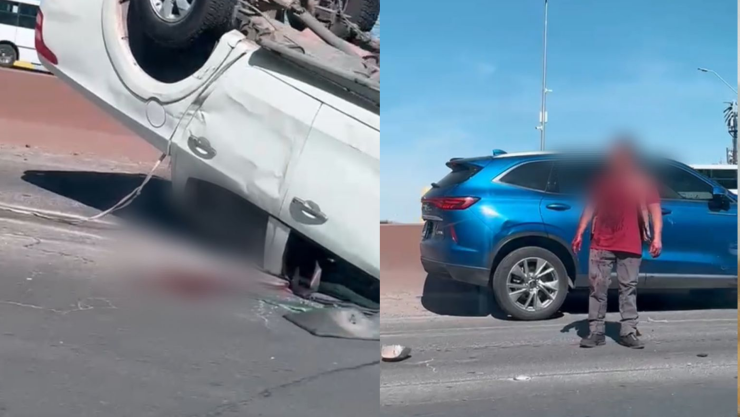 Hombre camina sin mitad de cara tras accidente en Chihuahua