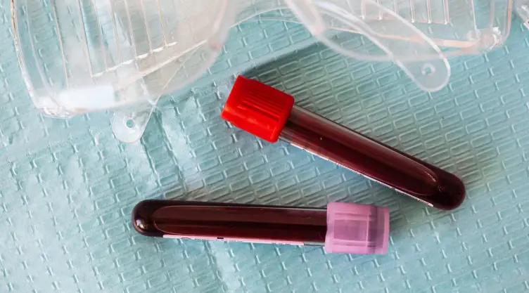 ¿Cuáles son los requisitos y dónde se puede donar sangre en CDMX?