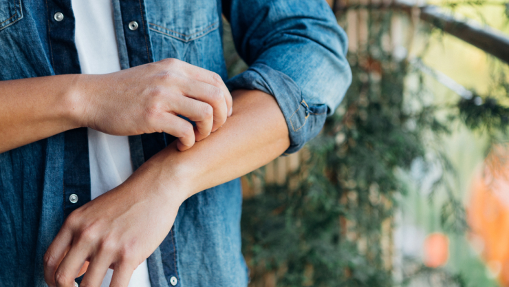 Los motivos por los que nos pica la piel