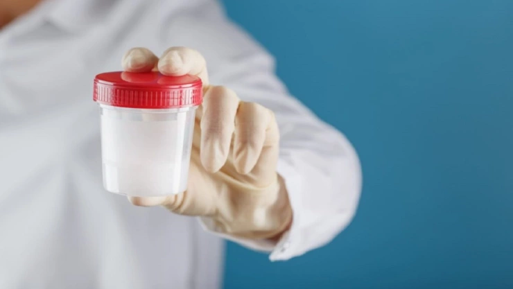 donación de esperma