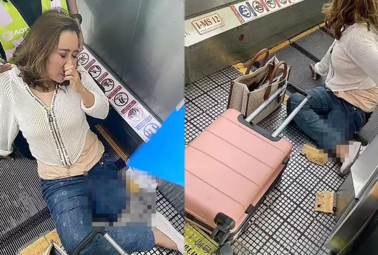 Turista perdió su pierna en la cinta transportadora del aeropuerto