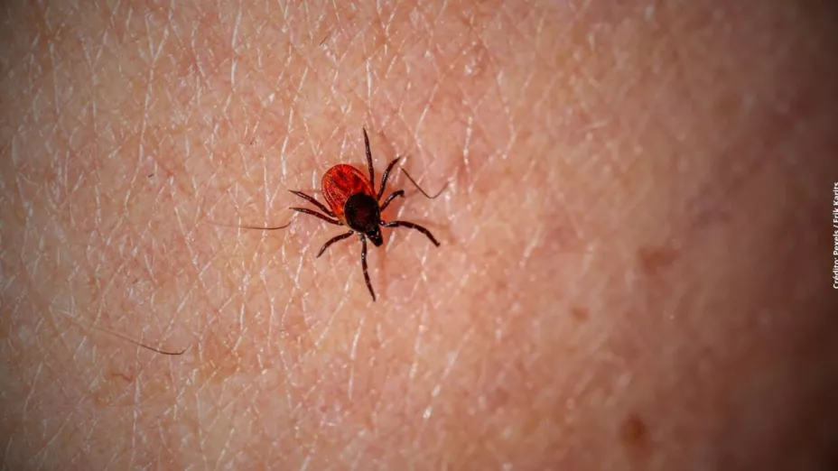 rickettsiosis
