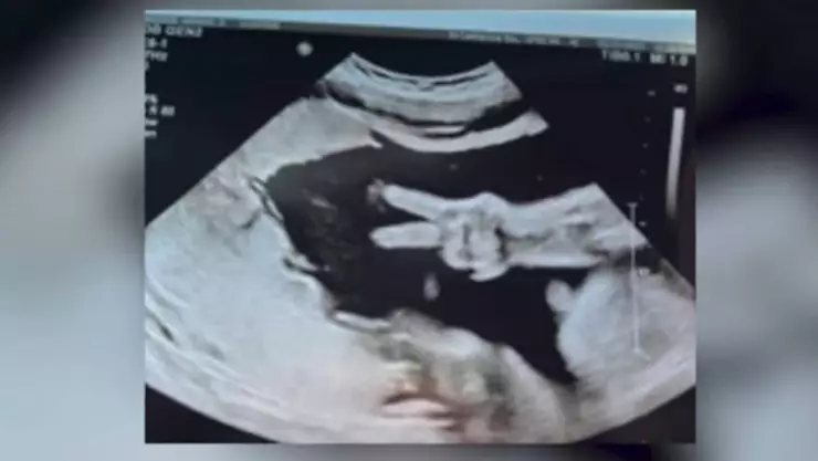 Bebe saluda en ecografia.