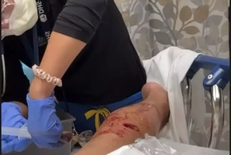 Gaby Ramírez preocupa a sus seguidores tras ser atacada por un perro (1).jpg