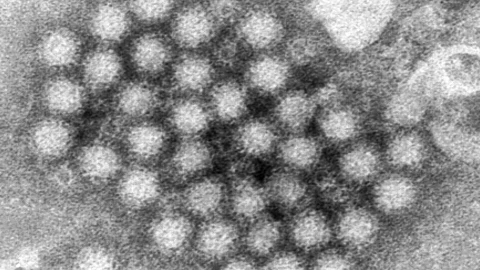 Norovirus