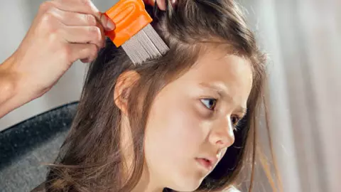 Los 3 tips para EVITAR los PIOJOS y mantener la cabeza libre de estos molestos insectos