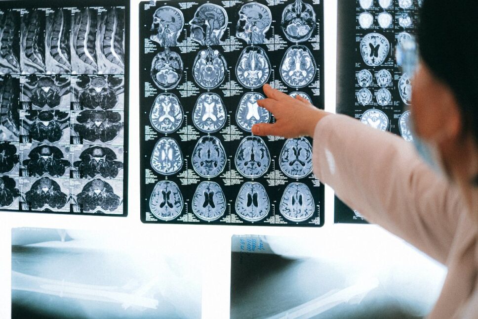 Enfermedades que atacan al cerebro