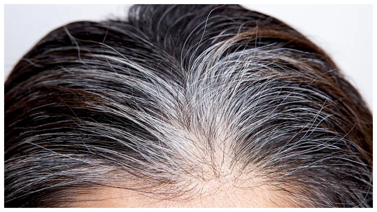 canas