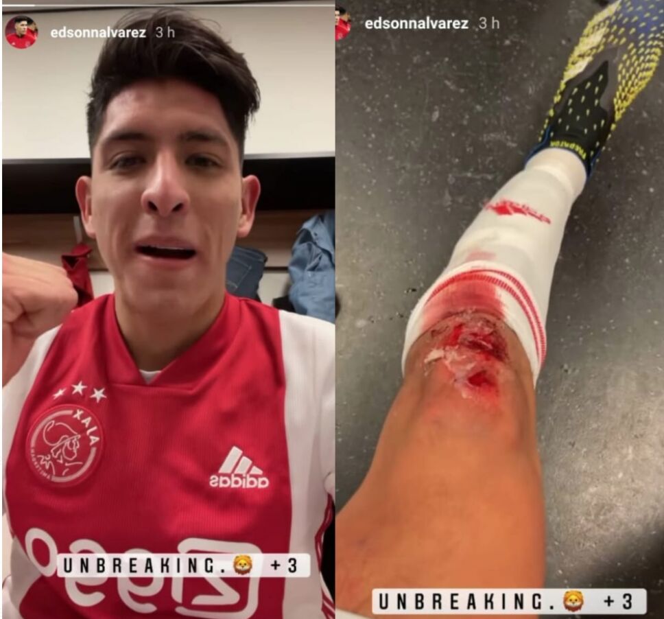 Edson Álvarez y su brutal herida con el Ajax