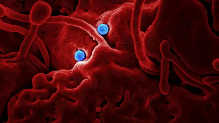 Detectan el primer caso mortal del ‘Virus B’ en humanos; conoce los síntoma y cómo se transmitió