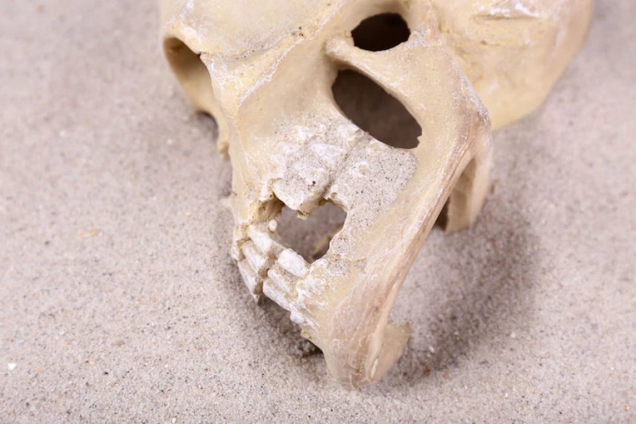 Reconstrucción ósea