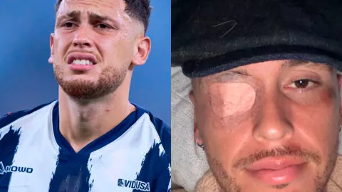Lucas Ocampos sufre parálisis facial: ¿Cuál es el estado de salud del jugador de Rayados?