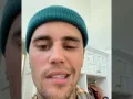 Justin Bieber paralisis.jpg