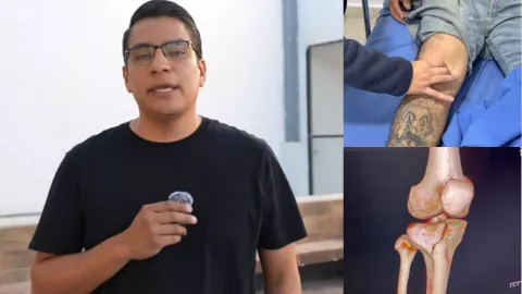 ¡Imágenes fuertes! El influencer Arqui Juve confirma accidente vial; la rodilla de uno de sus trabajadores quedó atrapada