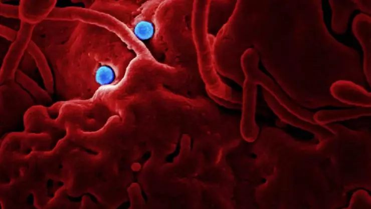 Alaskapox_ El nuevo virus que podría llegar a México, estos son sus síntomas.jpg