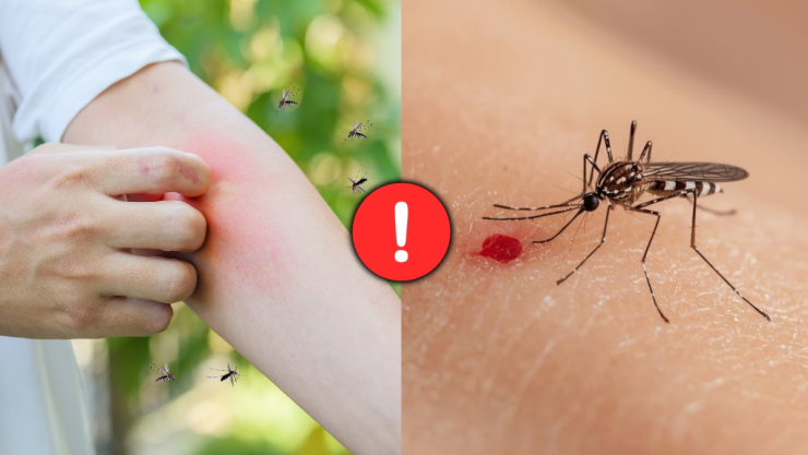 /estilo-de-vida/significado-mosquitos-piquen-a-unas-personas-que-a-otras