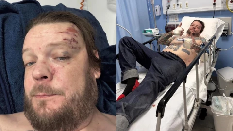 Corey Harrison de ‘El Precio de la Historia’ resultó gravemente herido tras accidente en Tulum: Esto se sabe