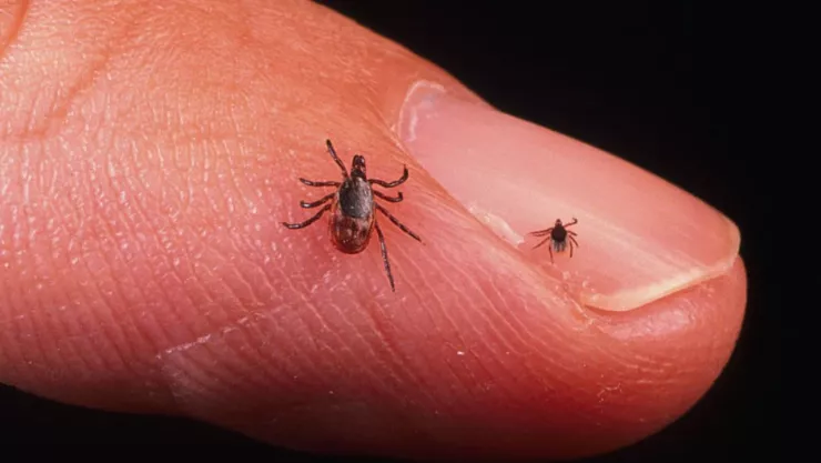 picadura de garrapata deja calva a mujer