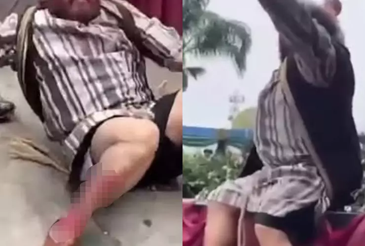 Actor de viacrucis viviente se ROMPE la pierna tras fuerte accidente en Viernes Santo; así quedó grabado en video