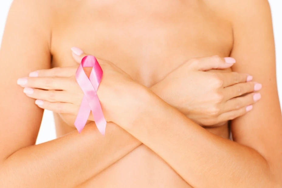 Cáncer de mama