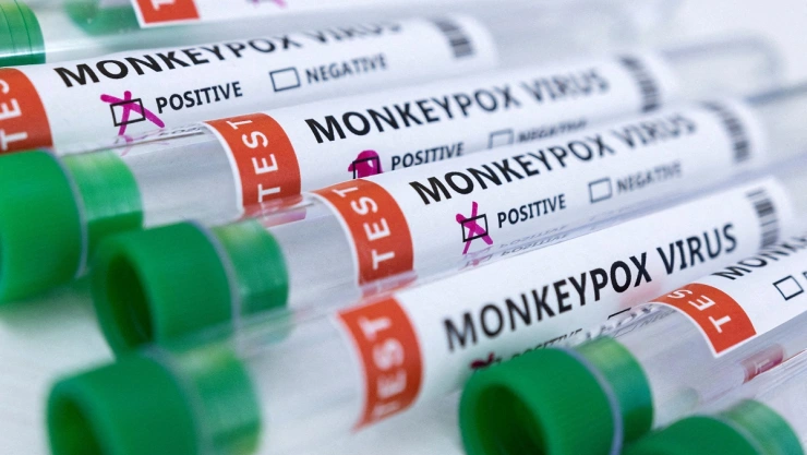 Preocupa transmisión de viruela del mono; hallan el virus en semen
