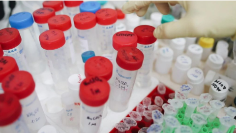 casos de vih en yucatan cifras 2025