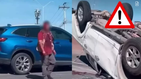 Hombre pierde la mitad la mitad de su rostro Chihuahua