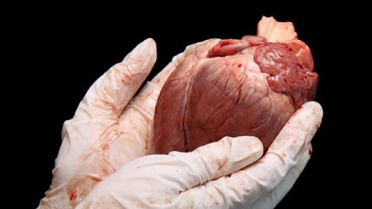 ¿Qué se celebra este 27 de febrero Día Mundial del Transplante de Órganos