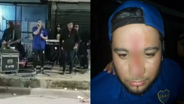 Cantante agredido con aire comprimido