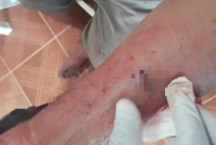 Perro pitbull ataca a su dueño de la tercera edad en Yucatán